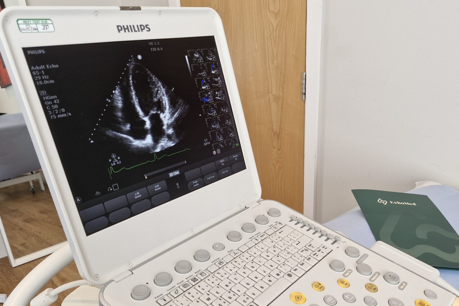 An echocardiogram ultrasound machine.